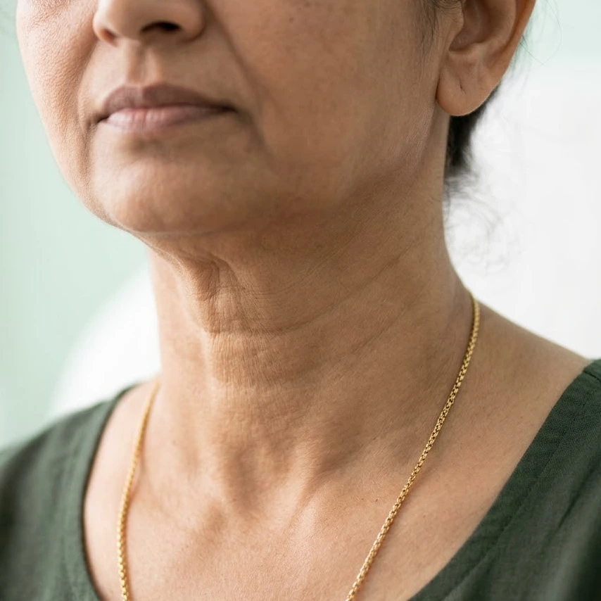 Anti-Wrinkle - Neck Bands (Nefertiti) in Bangalore Clinical Assessment & Treatment - Dermis 365 Bengaluru
